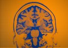 DARPA testuje wszczepiane do mózgu czipy sztucznej inteligencji zmieniające nastroje.