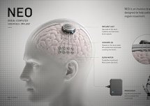NBIC: Chiny tworzą swój własny czip wszczepiany do mózgu ala Neuralink.