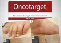 Szokujące nowe badanie łączące szczepienia na Covid-19 z rakiem znika z sieci.