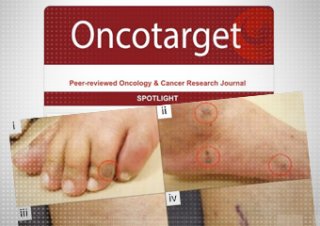 Szokujące nowe badanie łączące szczepienia na Covid-19 z rakiem znika z sieci.